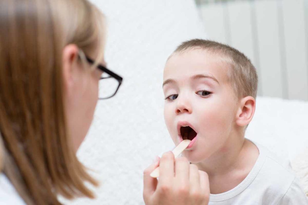 child-having-tonsils